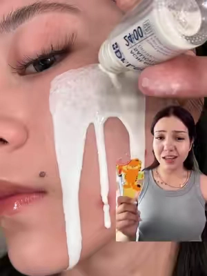 I like this!@Dr.Leo-USA #weeklydealsn #summerwins #acne #acneskin #acnetreatments 