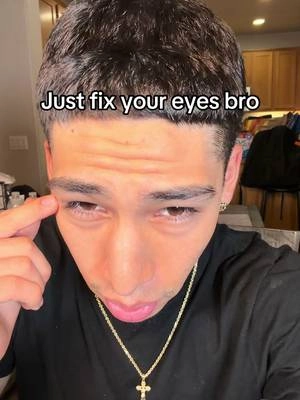 How to fix your eyebags #eyebags #finelines #smilelines #matureskin #darkcircles 