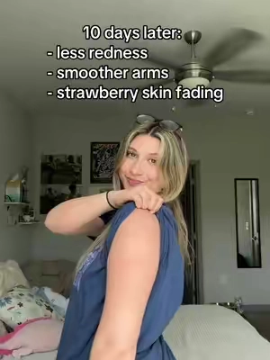 i never thought my KP would go away 🥲 #KP #strawberryskin #skintransformation #keratosispilaris 