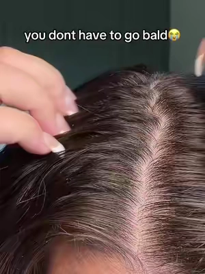 Hair issues? Try @LILYEVE GLOBAL serum!!  it’s not medical advice. These are my own opinions always do your research results may vary!!  #lilyeve #hairgrowthserum #hairloss 