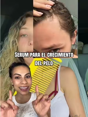 Serum para el crecimiento del pelo con cepillo incluido 🫶🏻💕💫 #hairloss #thinhair #hairgrowth #hairserum #vtcosmetics @VT Cosmetics US 