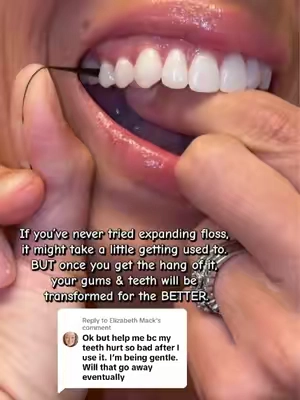Replying to @Elizabeth Mack great question and I hope these tips help! Keep going! The more you floss the less your teeth and gums will hurt! If you’re only flossing because your dentist told you to, I want you to know it can actually CHANGE the way you feel about flossing. 🥹🦷 This expanding floss has 300+ strong fibers that spread as you floss, helping reach more surface area and grab the plaque and debris hiding between your teeth and along your gumline. It’s clinically proven to remove up to 2X more plaque than regular unwaxed floss, and that BLACK floss lets you actually SEE what you’re removing and honestly, that can be the motivation you need to finally make flossing a daily habit. Your gums deserve more than a quick pass with floss…they deserve a deep clean you can actually feel. ❤️ #floss #flossing #cleanteeth #freshbreath #gumhealth 
