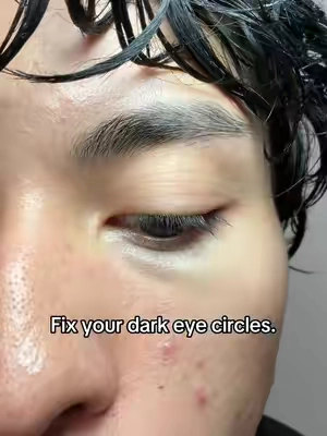 Easiest way to fix those dark circles #menpen #dark #eyebags #GlowUp 