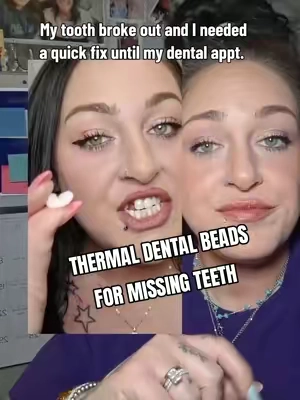 If you have a broken or missing tooth and struggling to find an affordable solution, check out these thermal dental beads. #missingteeth #missingtooth #teeth #tooth #brokentooth 