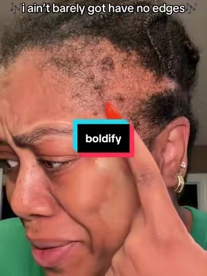 some days we’re growing it. Some days we’re covering it. TODAY we had somewhere to be. 😂 #hairlinepowder #hairfibers #hairlinecoverage #thinninghair #sparseedges @@boldify 