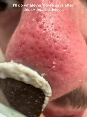 All the skincare advice in the world couldn't have prepared me for this. #cloggedpores #whiteheads #koreanskincare #largepores #ilso @ilso US 
