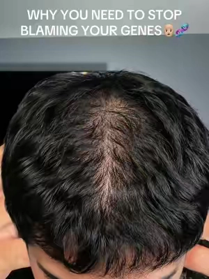 All organic hair sprays and ointments have been around for so long, most people forgot about them…👨🏼‍🦲🧬
