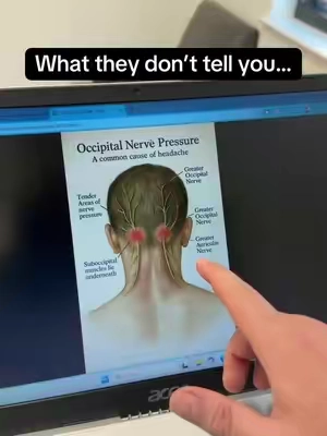 I love Alcedos cervical pillows. It helps keep my neck in good posture and also supports my head. #neckpain #headache #headacherelief #migrainerelief #migraines 