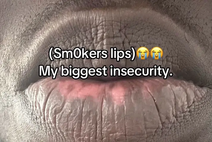 #drleo #lipcare #drylips #selfcareroutine #TikTokshopbacktoschool 
