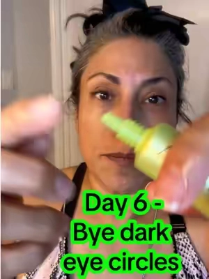 Dark circles or dark spots? Hopefully this will help. #arenciasummerchallenge #darkcirclesremedy #darkcirclecorrection #darkspotsremoval #darkspotcorrection 