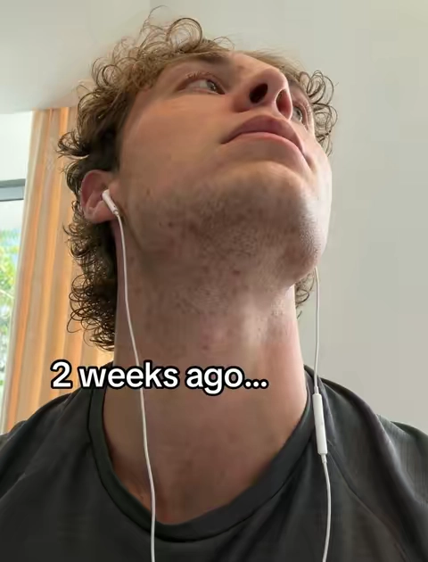 #bumppatrol 