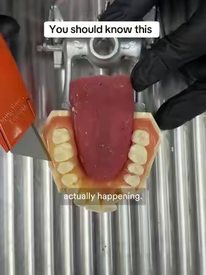 Do you know this??🫵🤷‍♂️ #tootharmour #ad 
