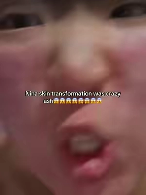 #fyp #ninadaddyisback 