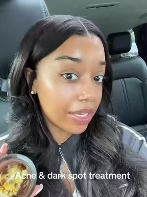 Look at this skin! No gate keeping here #fyp #skincare #medicube #kbeauty 