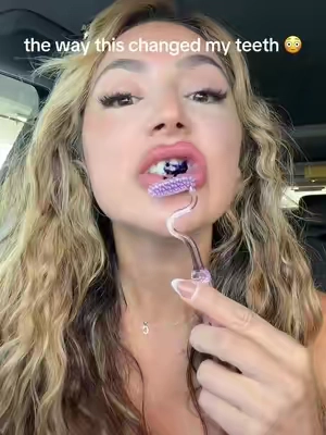 fresh & white teeth in 30 seconds 🤯 #hismile #teethwhitening #oralhygiene #whiteteeth 