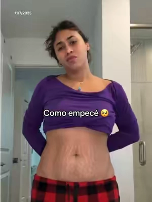 #estrias #stretchmarks #flacidez #beautyhacks #dealsforyoudays  Disclaimer: This is not a professional advice. Results may vary. This is based on my personal experience Only available in United States  Ad @Gopure 