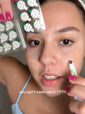 these pimple patches are insane?!?!