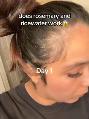 Postpartum shedding, alopecia coming and going… my hair has been through it. This is one thing I’ve stayed consistent with because I truly have faith in it. Everyone’s results are different, but these are mine. Watch until the end for Day 27. ❤️ #HairLoss #hairtok #RosemaryRiceWater #hairtransformation #postpartumhairloss 