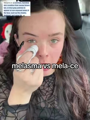 my mom is next 😭😅 #drmelaxin #melasma #hyperpigmentation #melace #tanningbed 