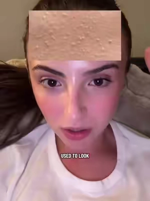 7687780562886561054