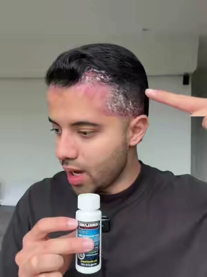Notaba mi cabello más fino, hasta que encontré esta tecnología. Ahora luce más fuerte. 💪🧴 #hairgrowth #hairthickening #volumehair #mengrooming #haircareproducts Disclaimer: results may vary