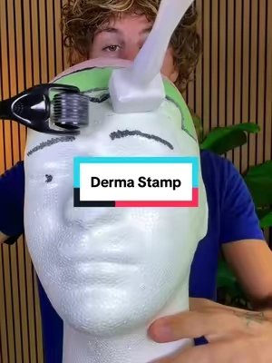 7688386777568021773
