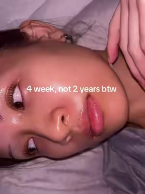 not gatekeeping😭🤍#acnescars #glassskin #345reliefcream #koreanskincare