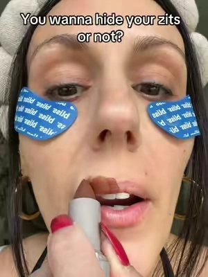 I almost lost the pimple patch 🤯