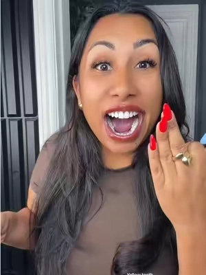 Yellow teeth! Teeth whitening! Tooth stain concealer! Hismile! Dental! Smile #teethwhitening #hismile #yellowteeth #dental #tiktokshopcreatorpicks @Hismile US 