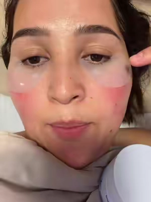 #fyp#viral#ojeras#