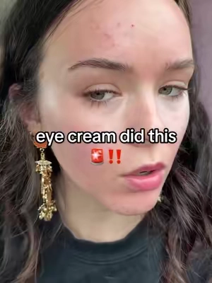 My concealer is probably gonna dry out ngl. #drmelaxin #eyecreamfordarkcircle #rebornic #covereyecream #cleangirlmakeup 