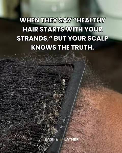 That's why our Scalp Therapy System makes it easy to tackle your hair concerns one step at a time. ✨ Pre-Poo: Softens buildup  💦 Shampoo: Cleanses the scalp 🫧 Conditioner: Nourishes your strands  💛 Leave-In: Adds moisture + definition to your curls & coils  Don't lie.. your scalp has been asking for this. Get the Scalp Therapy System today and give your scalp the fresh start it deserves. #baskandlatherco #scalptherapy #tellthetruth #healthyhairjourney #hairtok