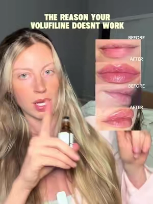 #onlytheordinary #volufiline 