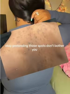 Dark spots, rough texture and uneven-looking body skin deserve a routine too. 🧡💛

Results may vary. Prices and promotions were accurate as of September 27, 2026 and may change. 

#chemistatplay #bodyhyperpigmentation #darkspots #strawberrylegs #bodycare 
