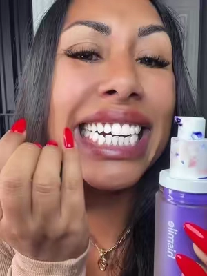 Yellow teeth’ teeth whitening! Tooth stain concealer! Hismile! Dental @Hismile US #teethwhitening #yellowteeth #hismile #dental #tiktokshopcreatorpicks 