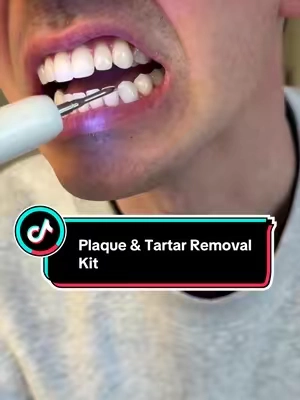 Stop letting that tartar build up on your teeth 🦷! Plaque & tartar removal kit to help keep those teeth clean 🧼 #teethhealth #toothcare #teethcleaning #tartar #teethwhitening 