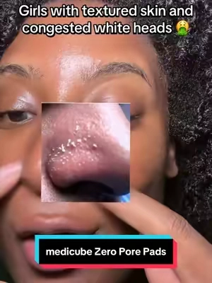 Press your nose. If white stuff comes out, you need these 😳 #medicube #sebaceousfilament #pores #tiktokshopcreatorpicks #tiktokshopfalldealsforyou 