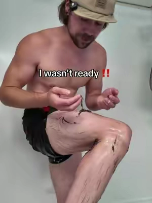 This stuff is wild! Never going back to waxing #hairremoval #hair #bodyhair #shave #wax
