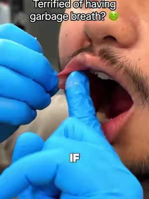 Is this you? 😳 #mouthwash #ad 
